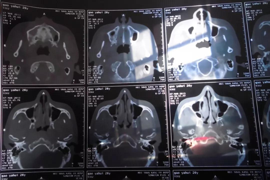 20190321/5c9347195987d.jpg 3211.jpg