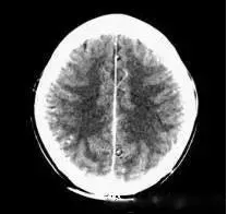 20200117/5e212b5bb5acc.png 22.png