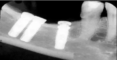 20200117/5e212b9f84537.png 24.png